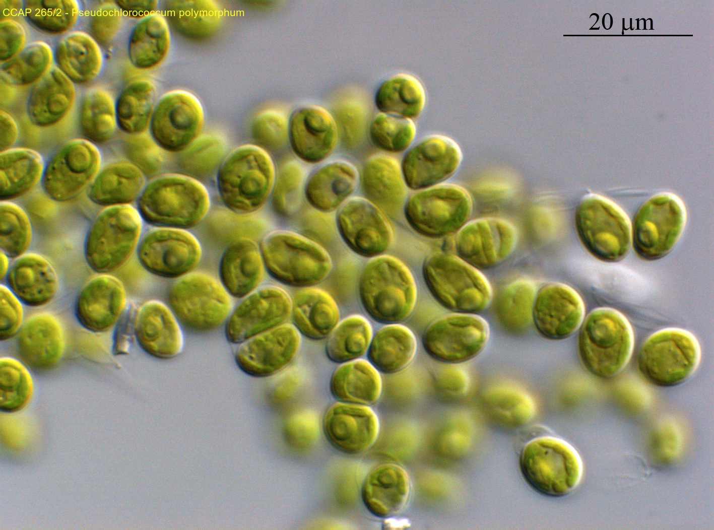 algae_Pseudochloroccum